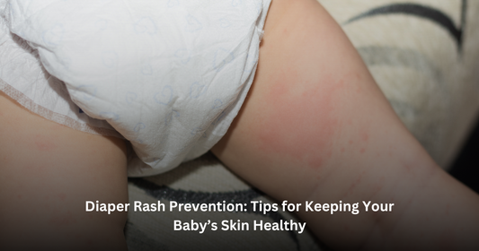 Diaper Rash Prevention: Tips for Keeping Your Baby’s Skin Healthy
